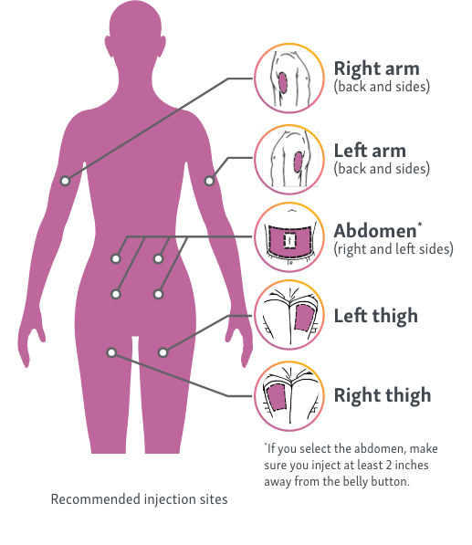 When injecting ACTIMMUNE, choose a site padded by fat below the skin such as your right arm, left arm, abdomen, left thigh or right thigh